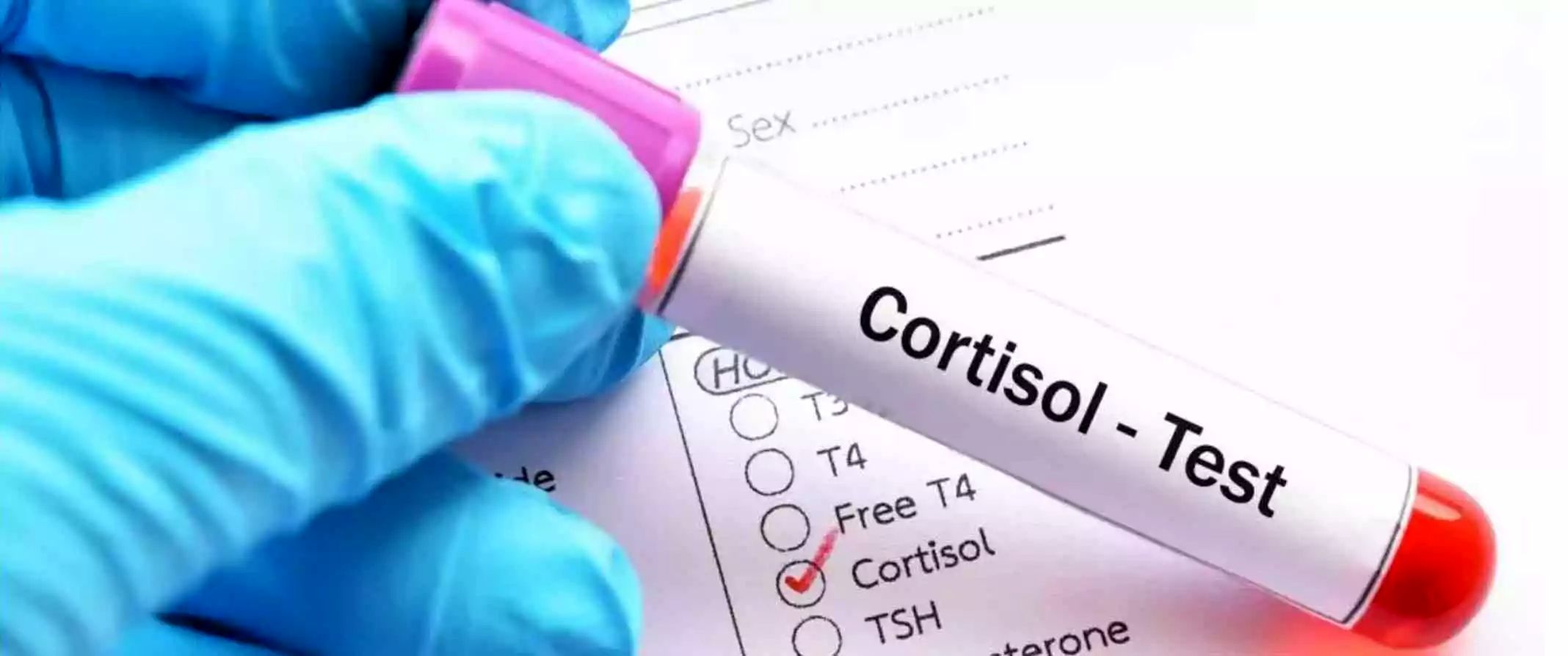 نشانه‌هایی که می‌گویند سطح کورتیزول بدن بالا رفته است