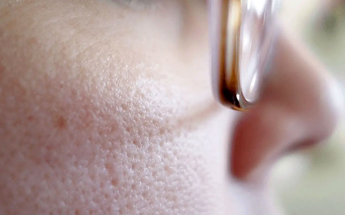 این چای را برای هیدراته نگه داشتن پوست میل کنید